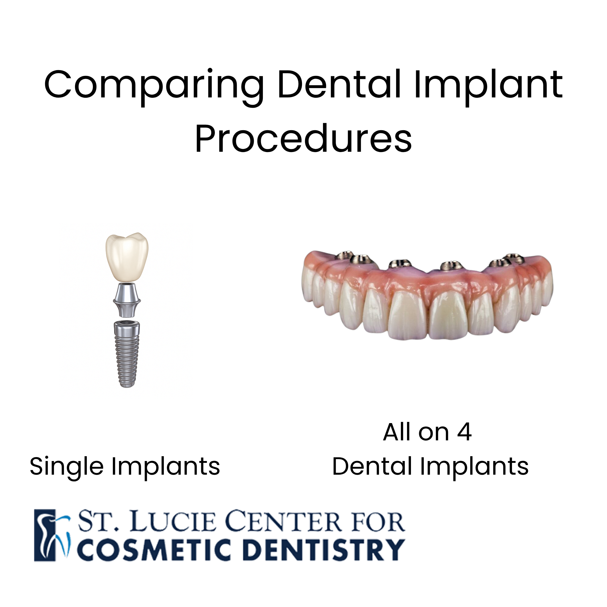 Comparison of Dental Implant Procedures