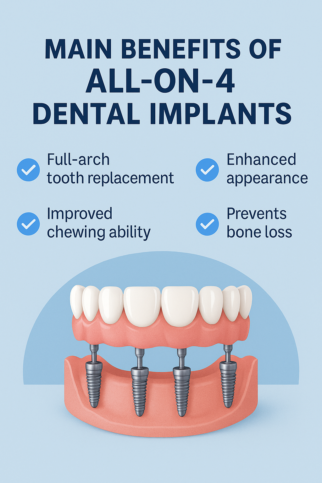Benefits of All-on-4 Dental Implants