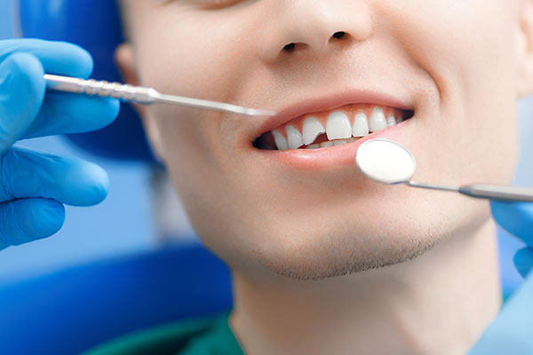 Chipped Tooth Repair In Port St  Lucie, FL
