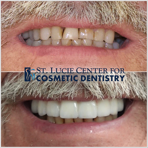 Smile Makeover Secrets: How To Transform Your Confidence In Weeks